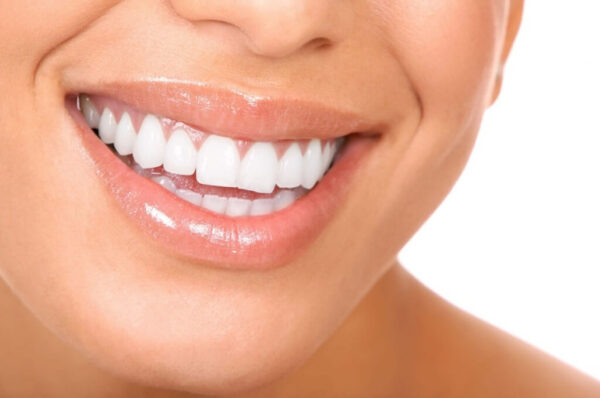 ابتسامة هوليوود (Hollywood Smile): هل هي مناسبة للجميع؟