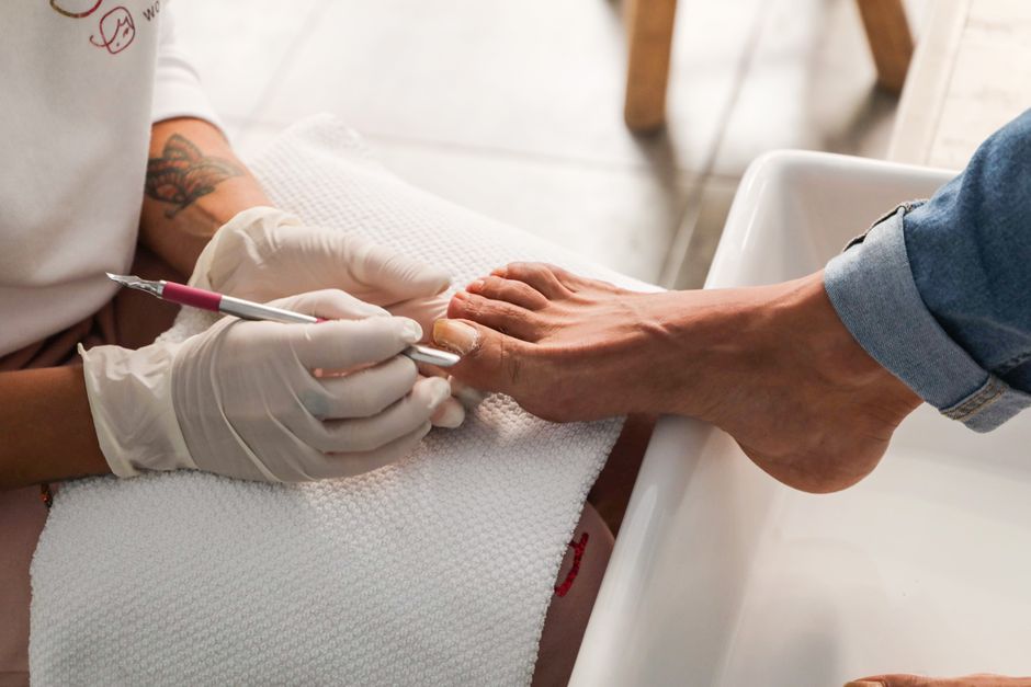 صحة الأظافر: أسباب أمراضها وأحدث طرق العلاج
