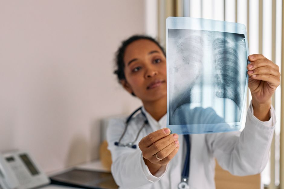 الالتهاب الرئوي: الأسباب، الأعراض، وطرق العلاج